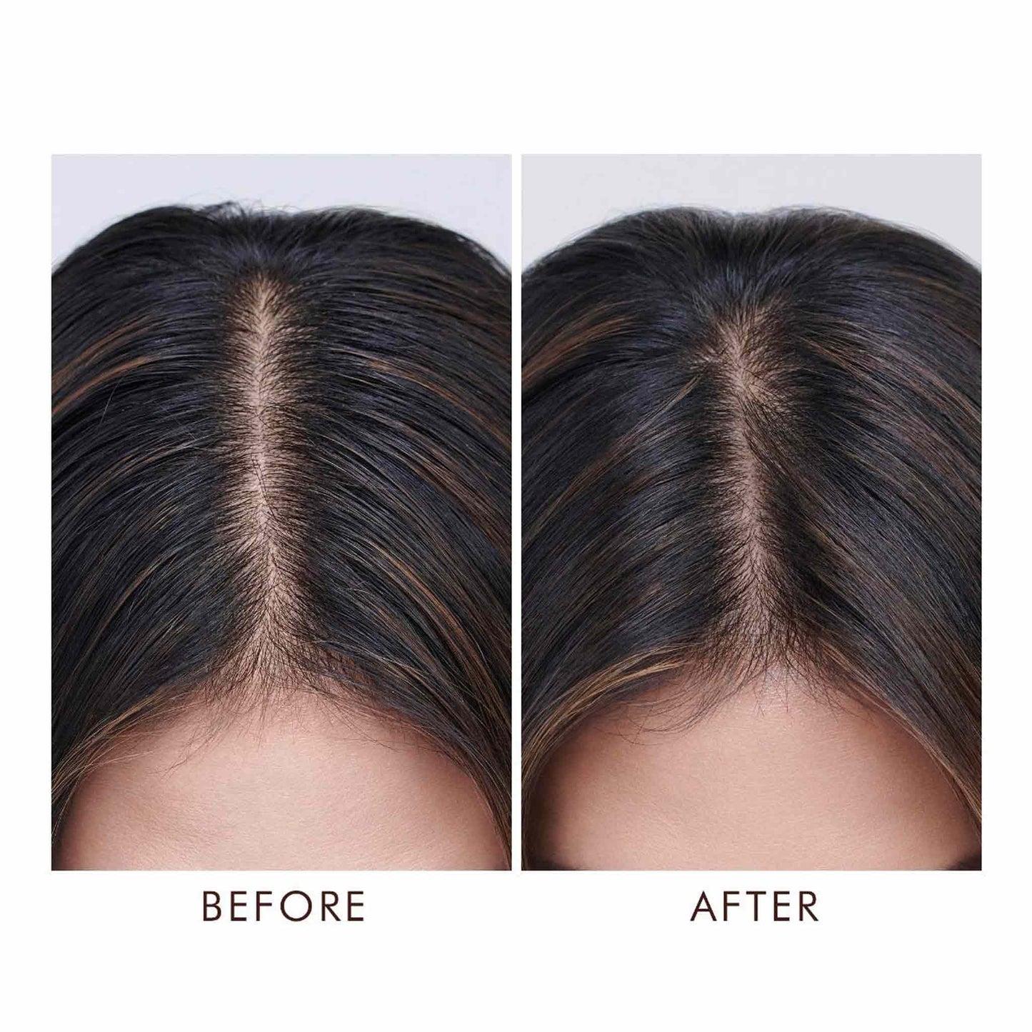 MOROCCANOIL Oil No More Scalp Treatment (45ml)